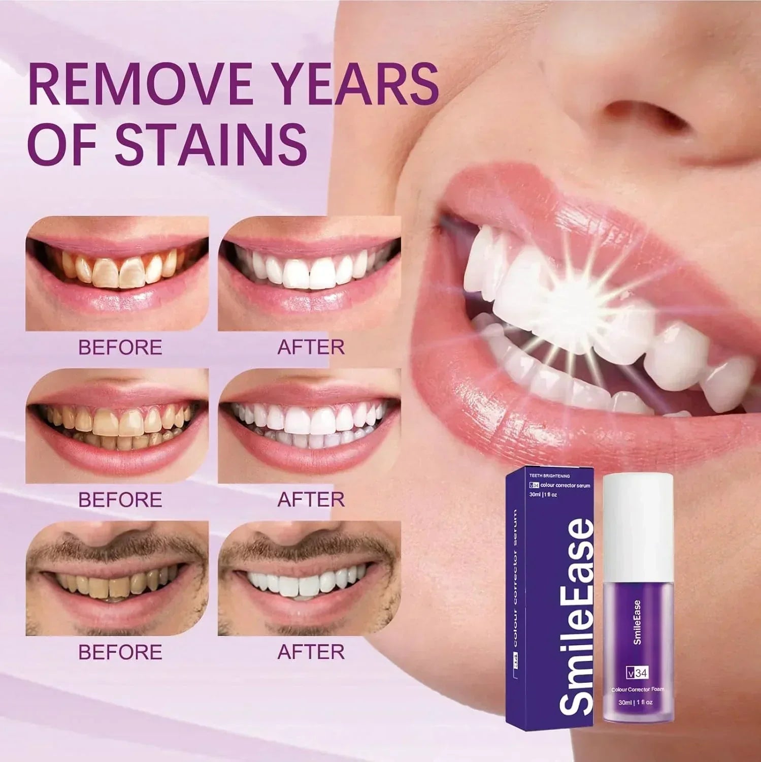 Smile Ease | ابتسامة سهولة